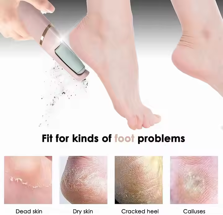 Electric Callus Remover | Removes rough skin